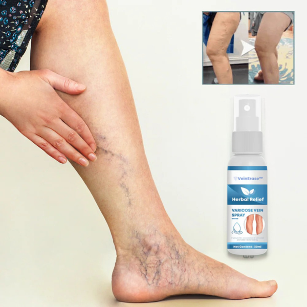 VeinErase Spray Tar bort 93 % av åderbråcken på bara 7 dagar!