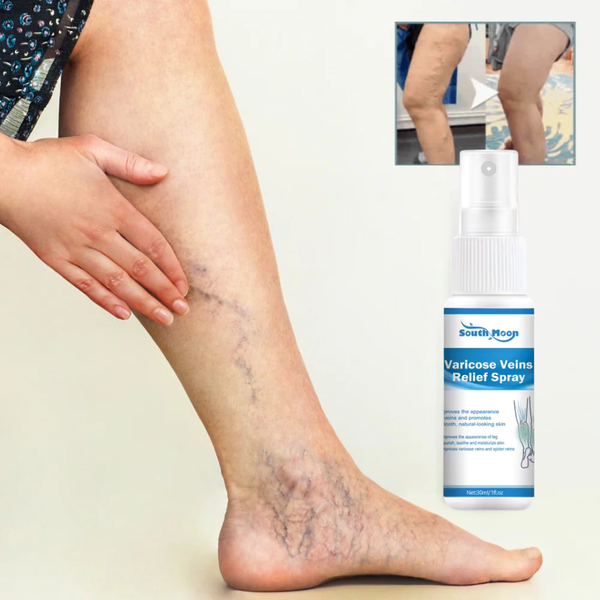 VeinErase Spray  Removes 93% of varicose veins in just 7 days!